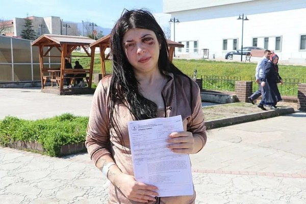 Samsun’da Damla Korkmaz sokak ortasında dehşeti yaşamıştı! “Yüzümde bir demirle sonsuza dek…”